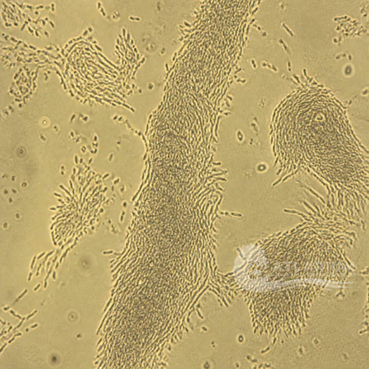 Bactéria da columnariose (Flavobacterium columnare)